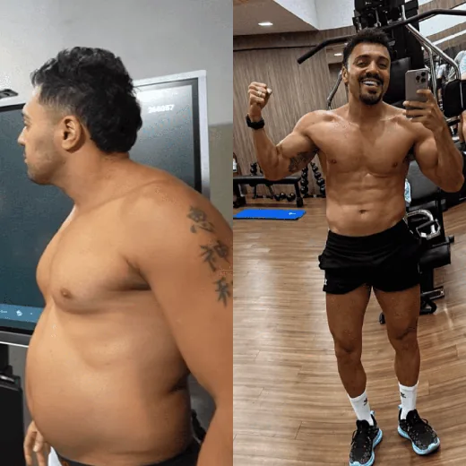 Antes e depois de Tirulipa com o Método Linares